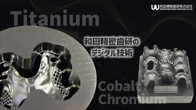 和田精密歯研のデジタル技術